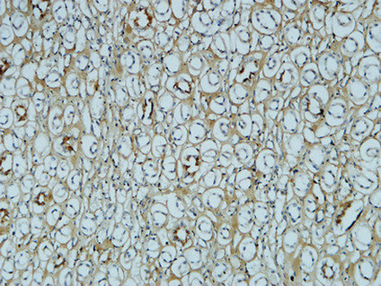Mouse Monoclonal Antibody to FN1