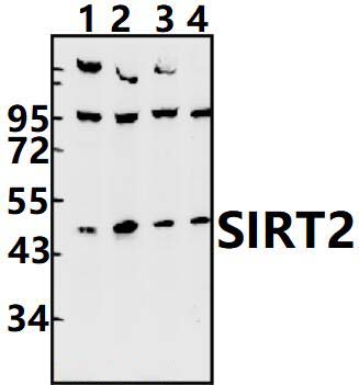 SIRT2