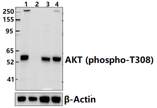 AKT (phospho~T308)