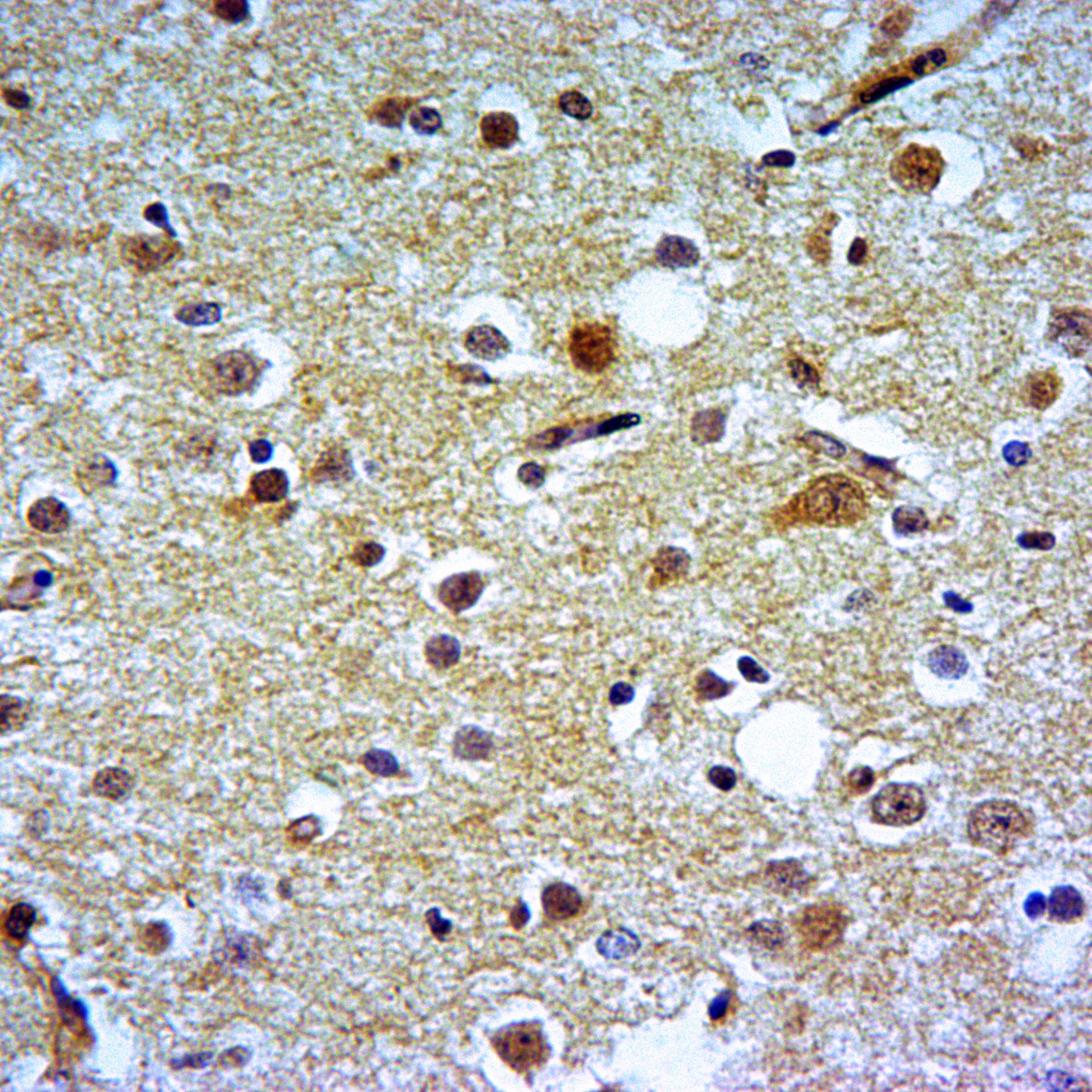 Rabbit polyclonal antibody to NFKB~p65
