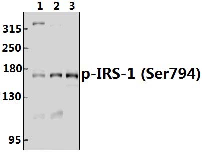 IRS~1 (Phospho~Ser794)
