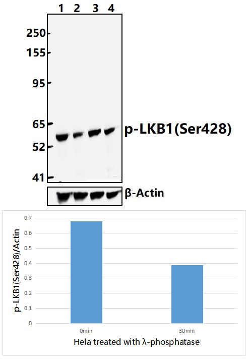 LKB1(Phospho~Ser428)