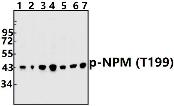 NPM (phospho~T199)