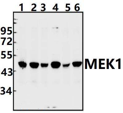MEK1 (Ser298)