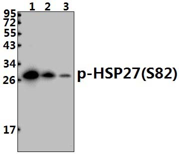 HSP27 (phospho~S82)