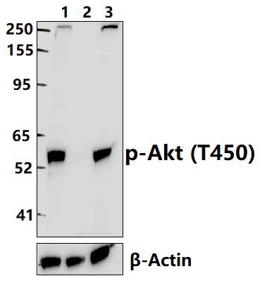 Akt (Phospho~T450)