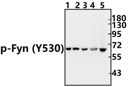 Fyn (phospho~Y530)