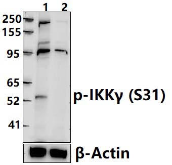 IKKγ (Phospho~S31)
