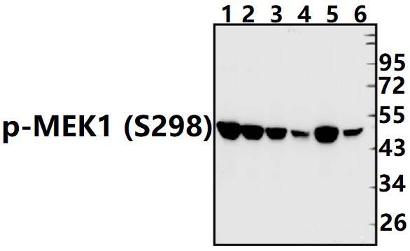 MEK1 (phospho~S298)