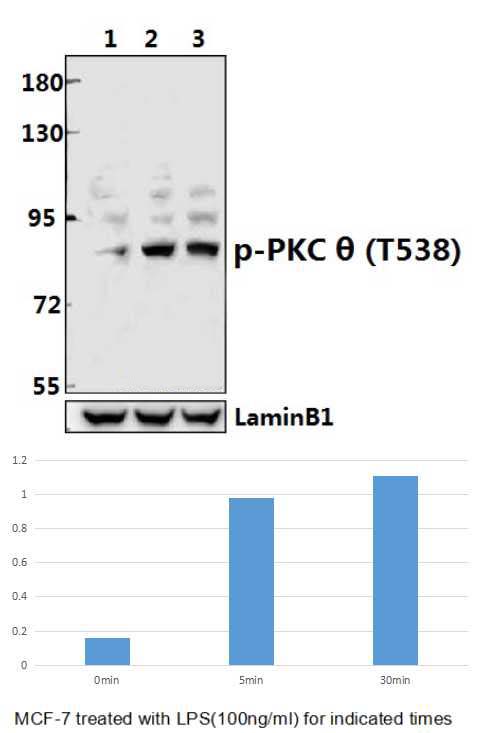 PKC θ (phospho~T538)