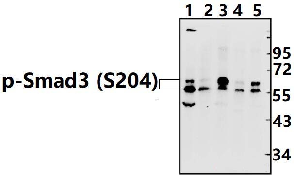 Smad3 (phospho~S204)