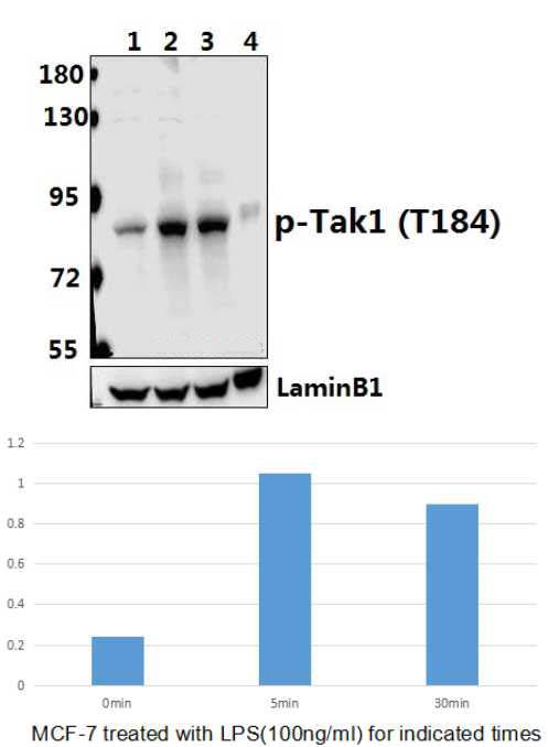 Tak1 (phospho~T184)
