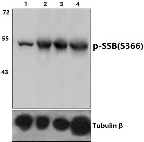 SSB (phospho~S366)