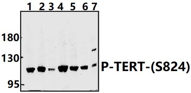 TERT (phospho~S824)