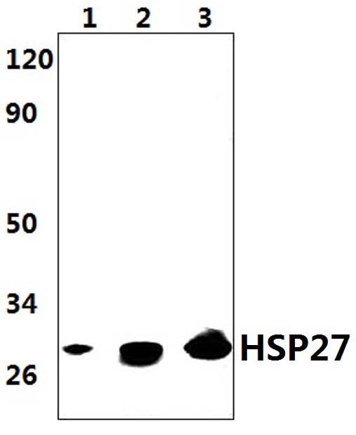 HSP27