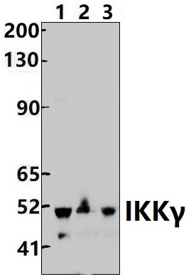 IKKγ (D25)