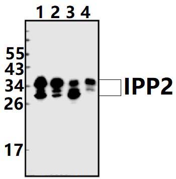 IPP2 (Q116)