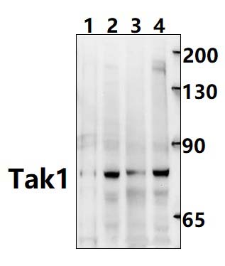 Tak1