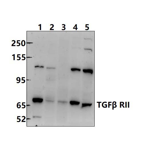 TGFβ RII (E246)