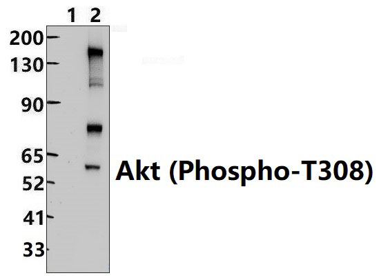 Akt (Phospho~T308)