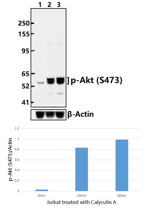 Akt (Phospho~S473)