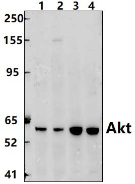 Akt (S473)