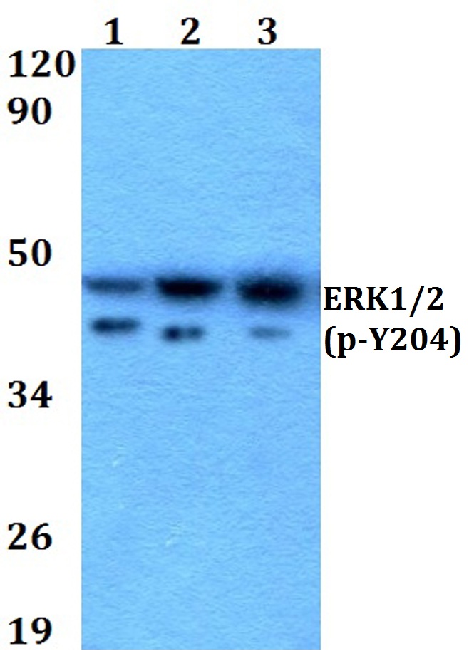 ERK1/2 (phospho~Y204)