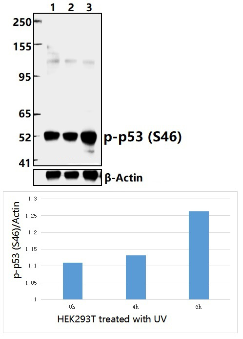 p53 (Phospho~S46)