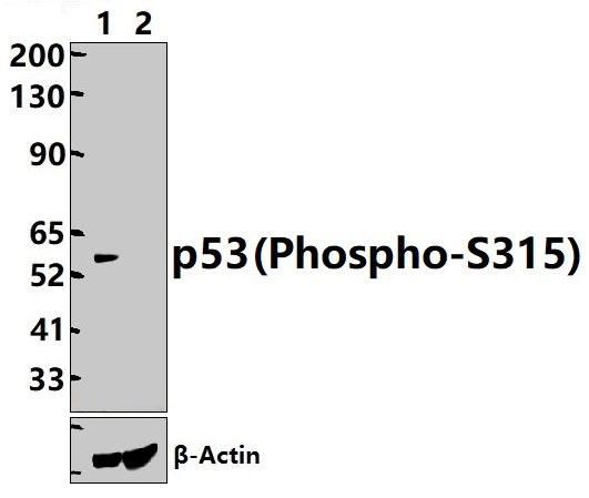 p53 (Phospho~S315)