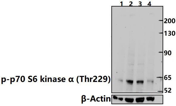 p70 S6 kinase α (Phospho~Thr229)
