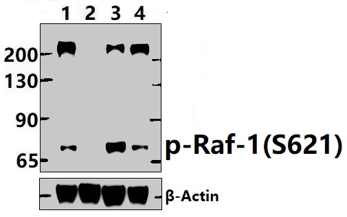 Raf~1 (Phospho~Ser621)