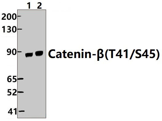 Catenin~β (T41/S45)