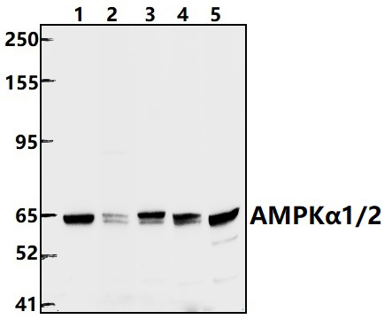 AMPKα1/2 (T174/T172)