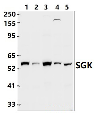 SGK (S422)