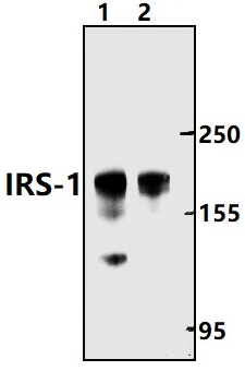 IRS~1 (S1101)