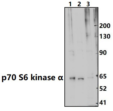 p70 S6 kinase α (T229)