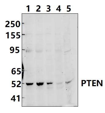 PTEN (S385)