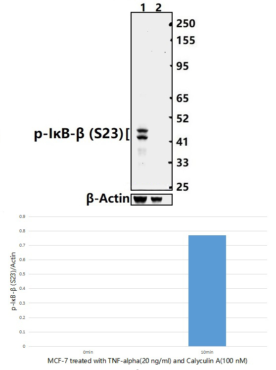 IκB~β (Phospho~S23)