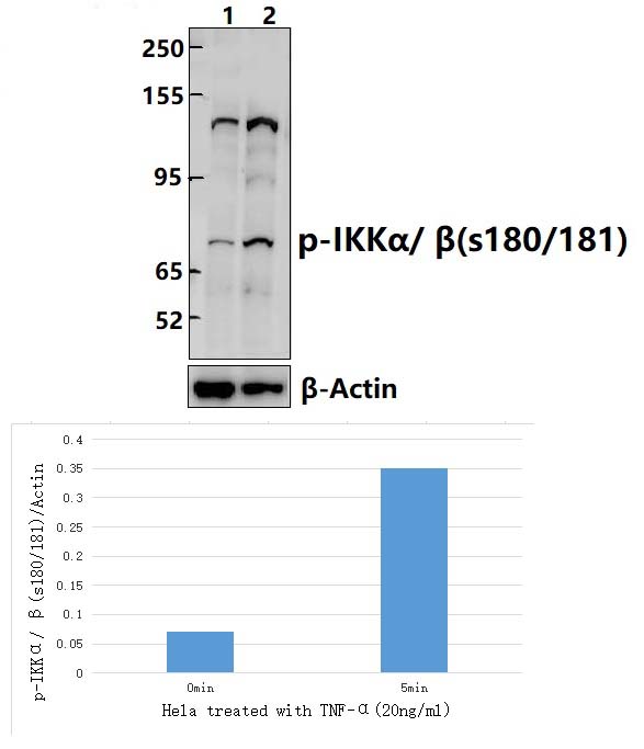 IKKα/β (Phospho~S180/181)