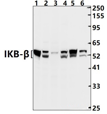 IKB~β (Y188)