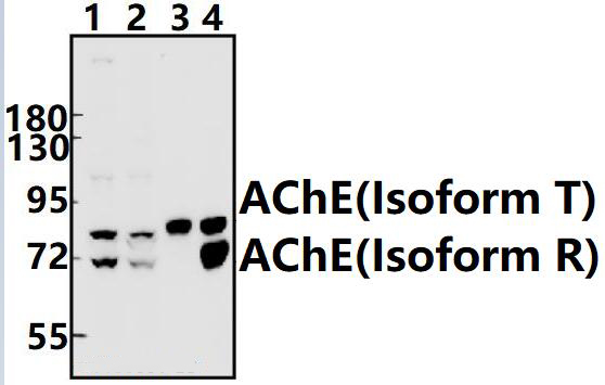 AChE