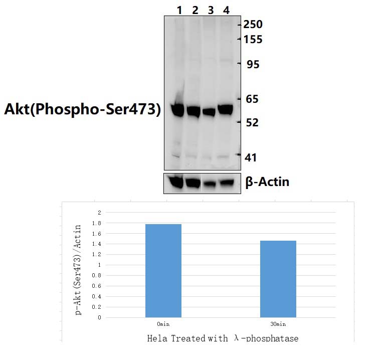 Akt (Phospho~Ser473)