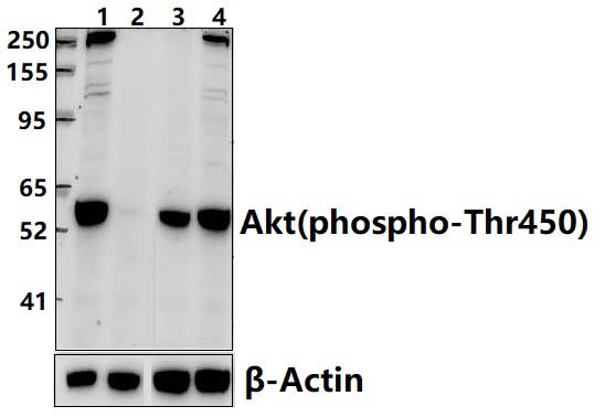 AKT (phospho~Thr450)