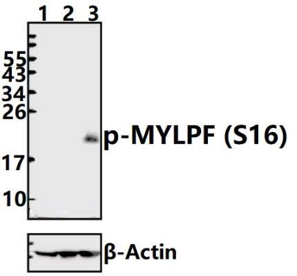 MYLPF (phospho~S16)