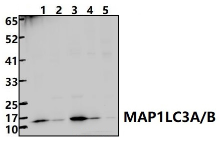MAP1LC3A/B (V244)