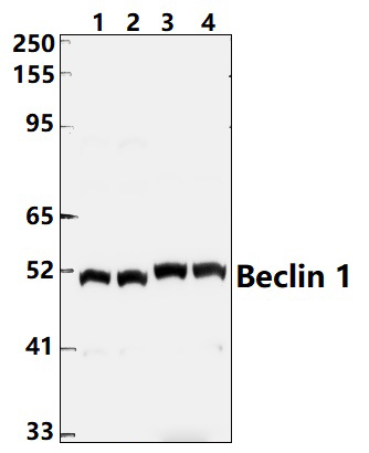 Beclin 1 (R238)