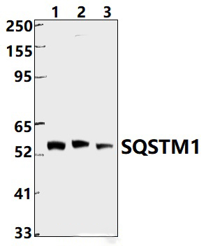 SQSTM1 (R415)
