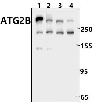 ATG2B (D2078)