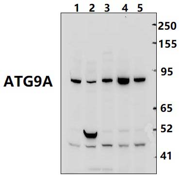 ATG9A (S848)