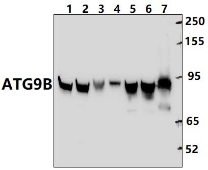 ATG9B (G883)